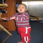 John Klein a la varicelle