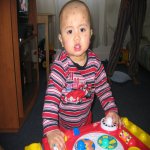 John Klein a la varicelle